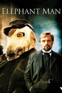 The Elephant Man 1980